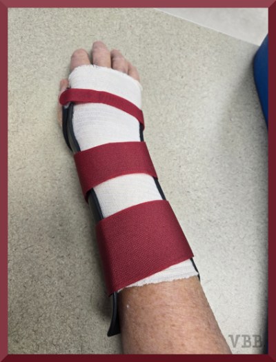 Photo of a right forearm in a black brace with red straps, resting on a table